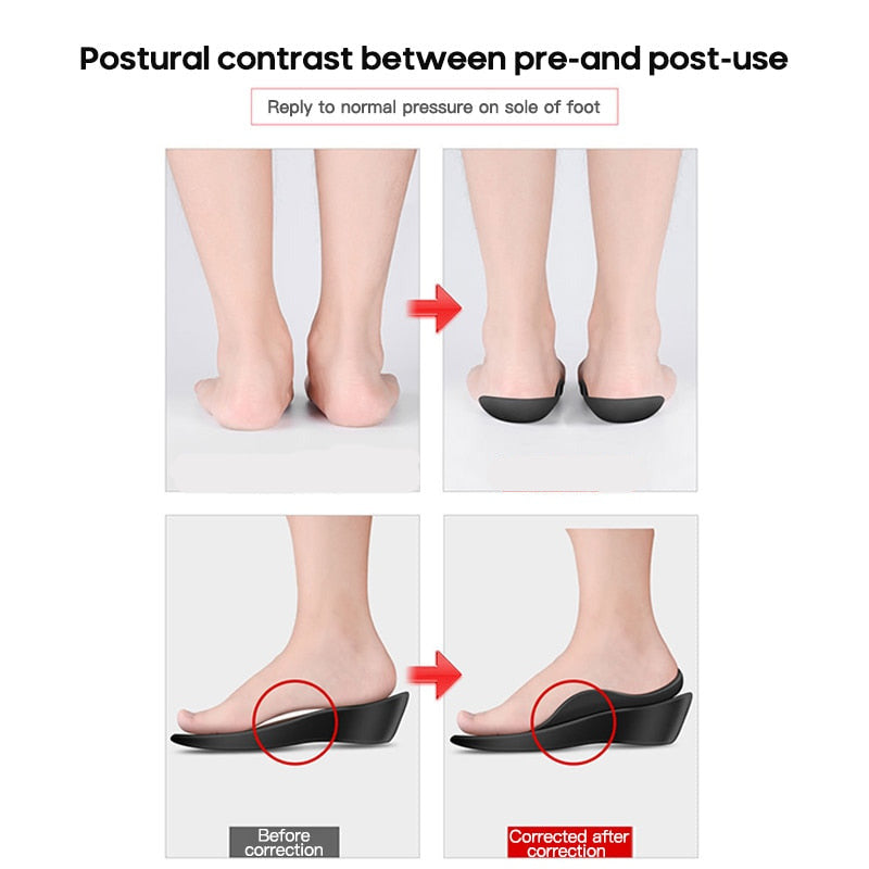 Flatfoot Orthotics