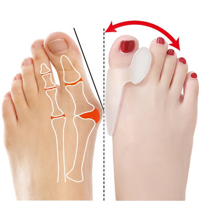 Silicone Big Toe Splint/Separator
