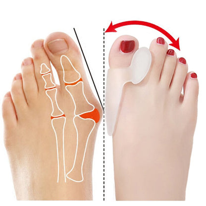 Silicone Big Toe Splint/Separator