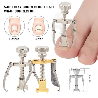 Ingrown Toenail Correction Tool