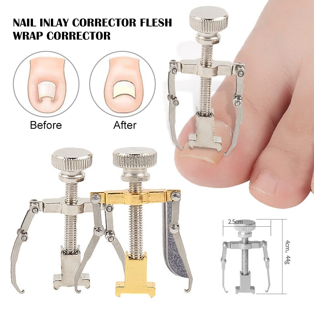 Ingrown Toenail Correction Tool