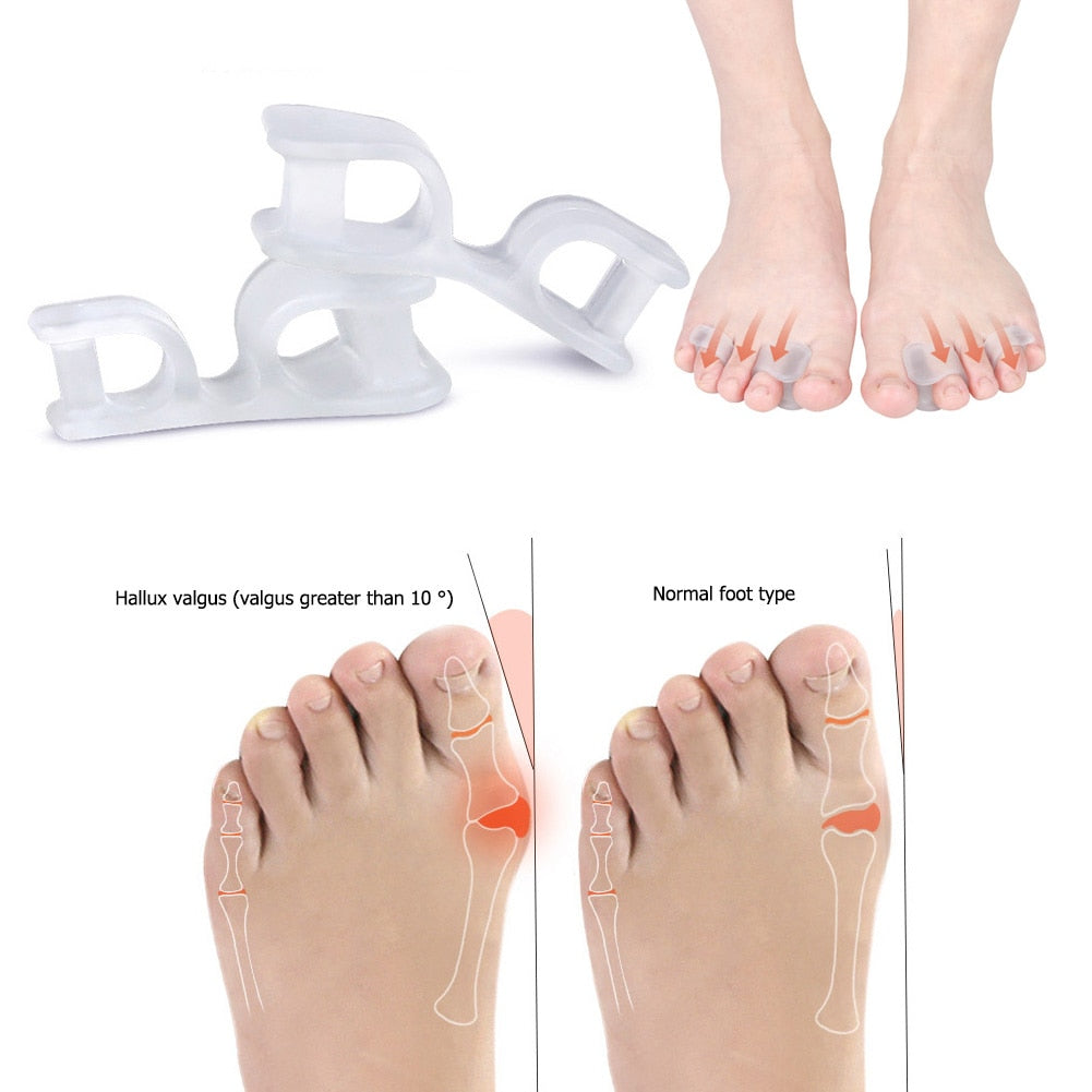 Overlapping Toe/Bunion Corrector